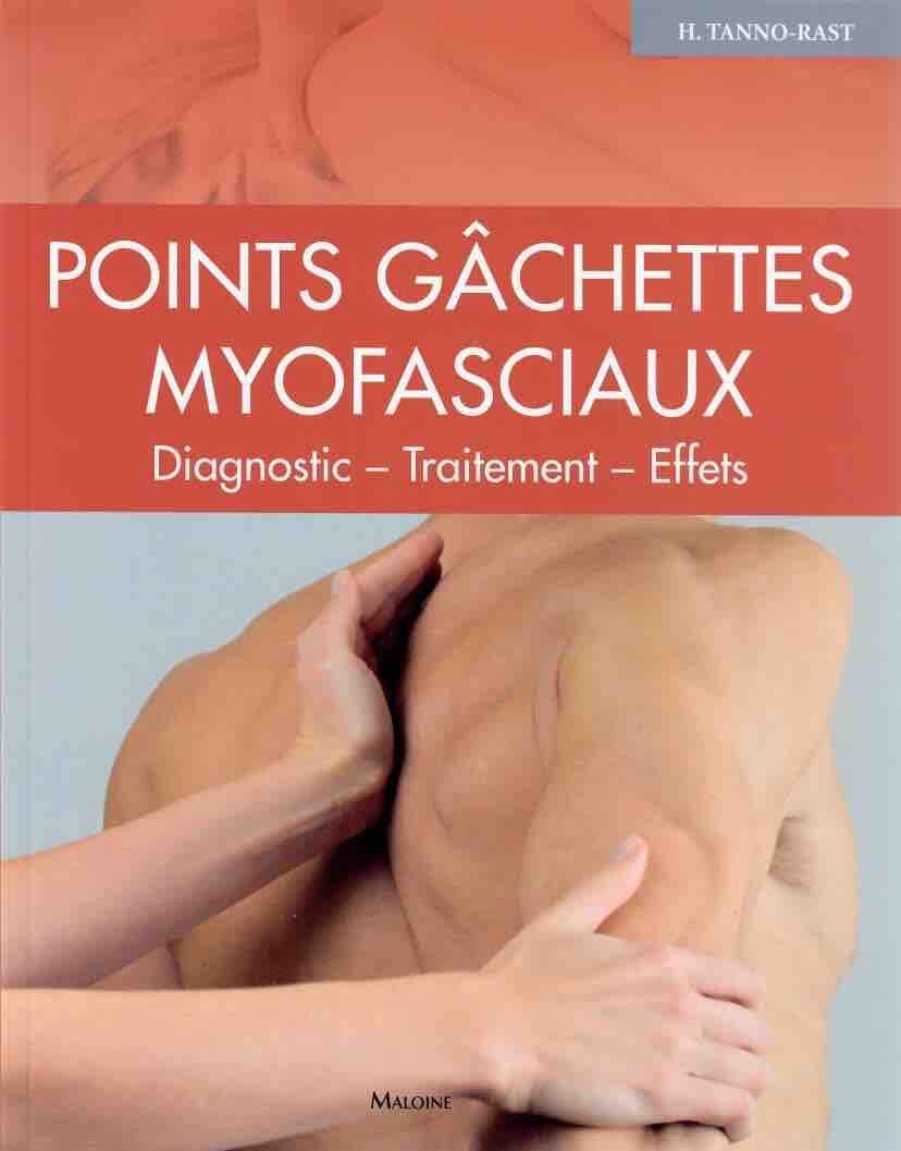 Points gâchettes Myofasciaux: Diagnostic ? traitement ? effets book