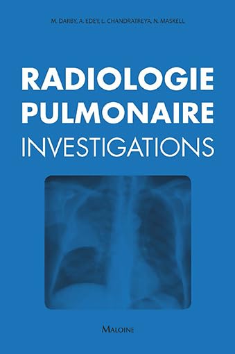 Radiologie pulmonaire : investigations book