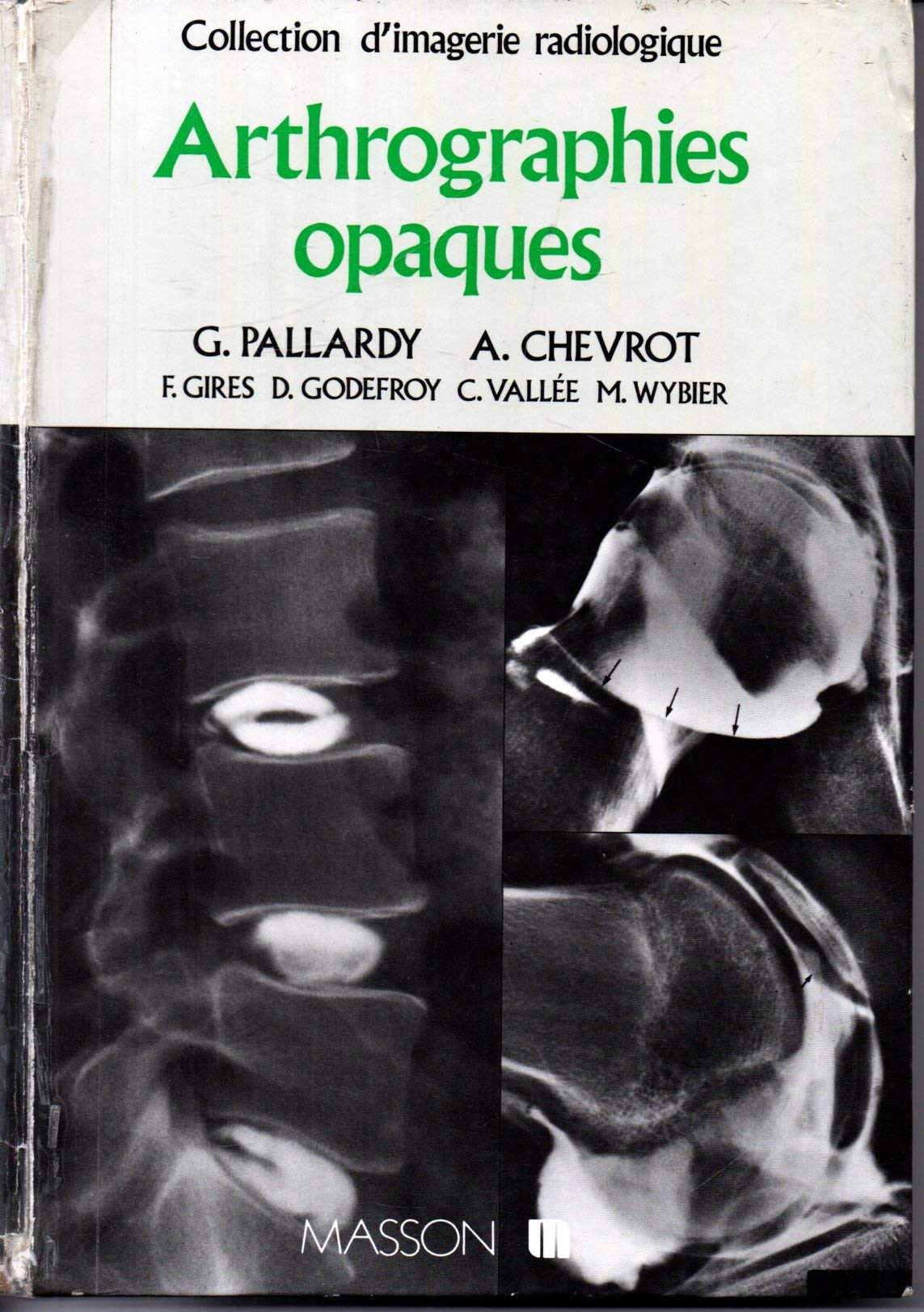 Arthrographies opaques (Collection d'imagerie radiologique) book