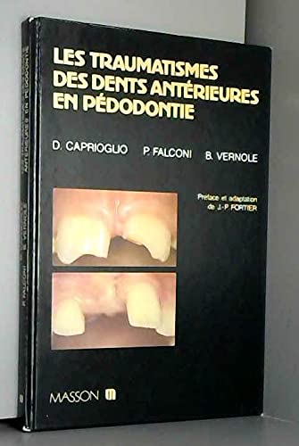 Les Traumatismes des dents antérieures en pédodontie book