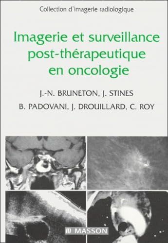 Imagerie et surveillance post-thérapeutique en oncologie book