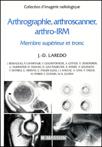 Arthrographie, arthroscanner, arthro-IRM, tome 1. Membre supérieur et tronc book