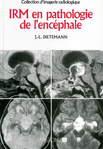 IRM en pathologie de l'encéphale book