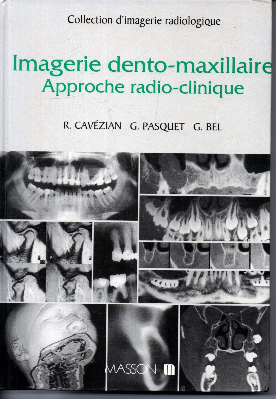 Imagerie Dento-Maxillaire. Approche Radio-Clinique book