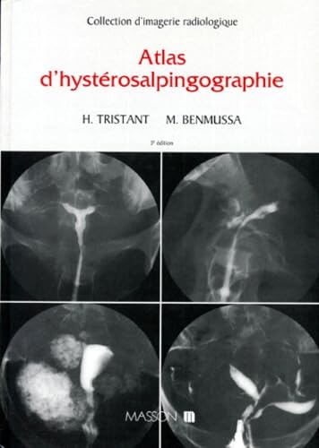 Atlas D'Hysterosalpingographie. 3eme Edition book