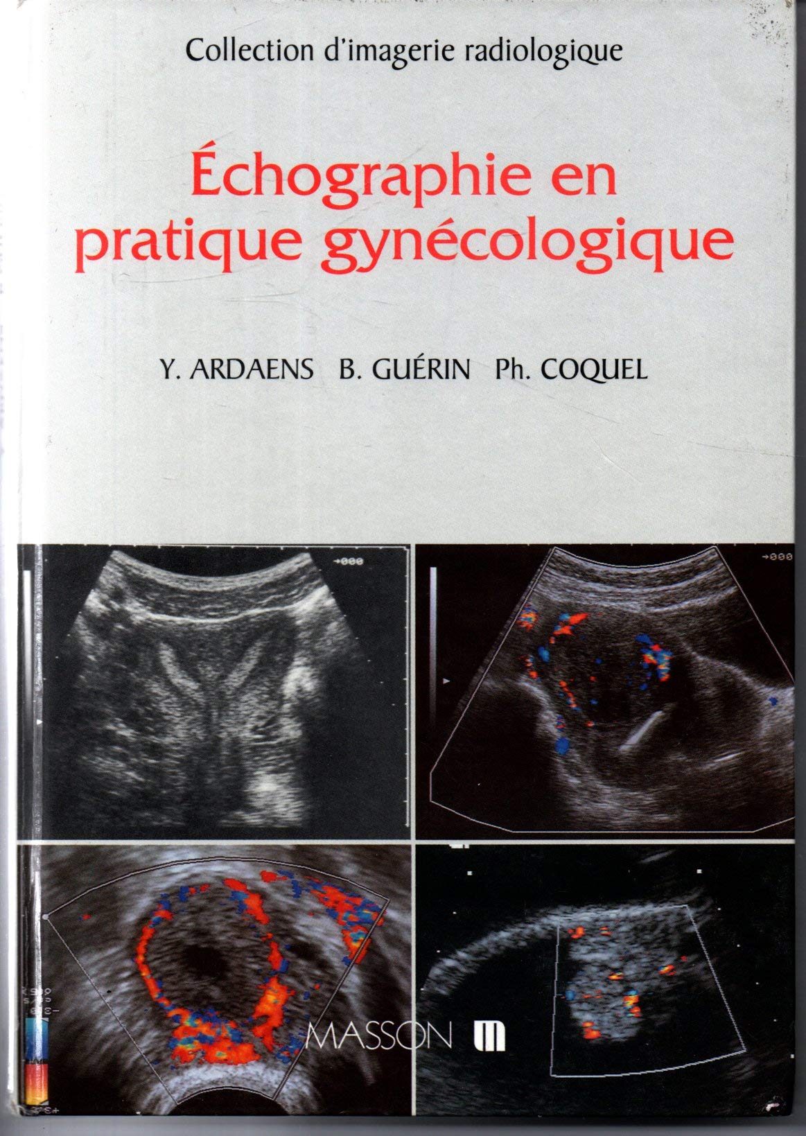 Echographie en pratique gynécologique book