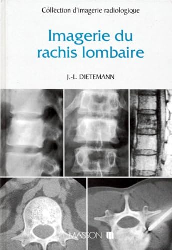 Imagerie du rachis lombaire book