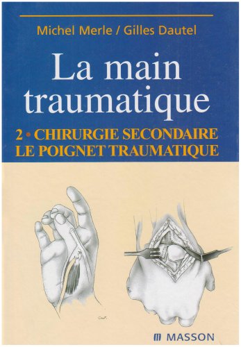 La main traumatique. Vol. 2. Chirurgie secondaire, le poignet traumatique Medicine