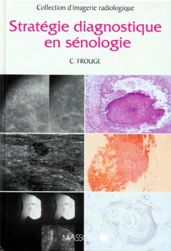 Stratégie diagnostique en sénologie book
