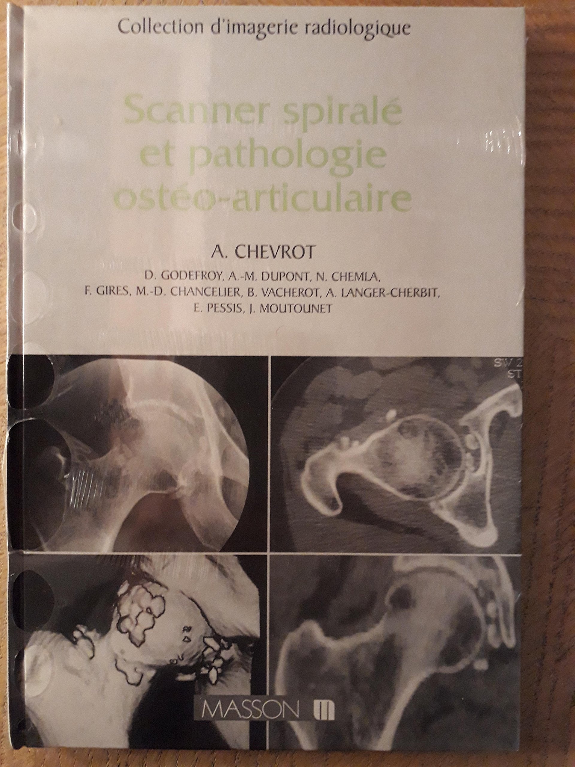 Scanner spiralé et pathologie ostéo-articulaire book