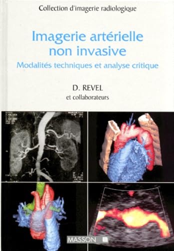 Imagerie Arterielle Non Invasive. Modalites Techniques Et Analyse Critique book