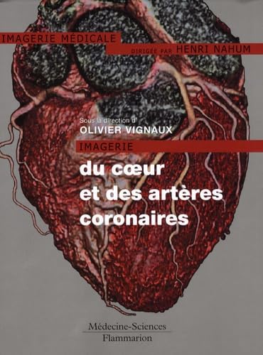 Imagerie du coeur et des artères coronaires Books
