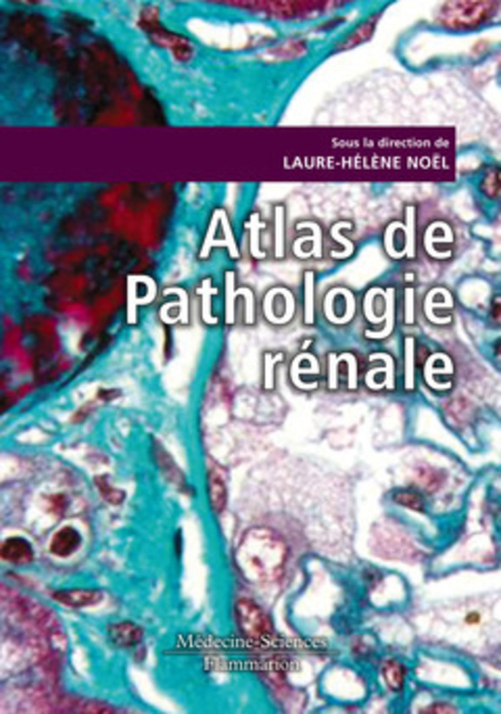 Atlas de Pathologie rénale book