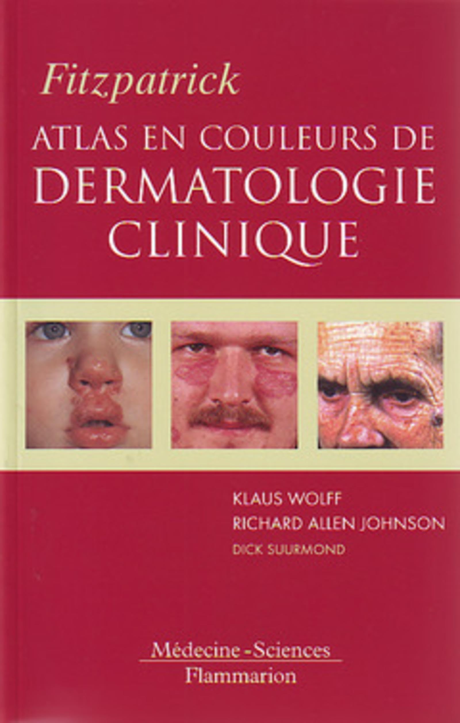 Fitzpatrick. Atlas en couleurs de dermatologie clinique book