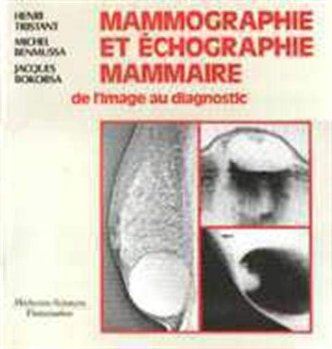 Mammographie et échographie mammaire: De l'image au diagnostic Books