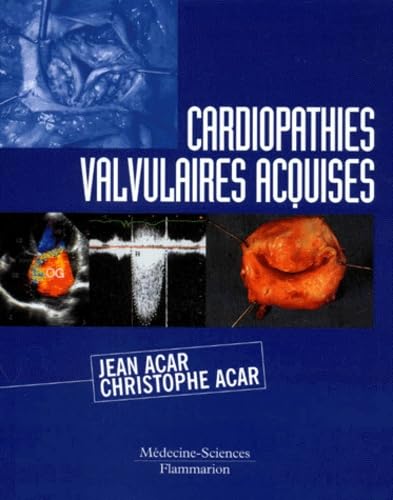Cardiopathies Valvulaires Acquises. 2eme Edition Books