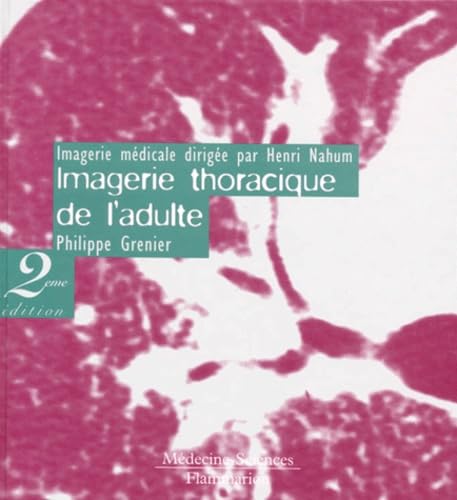 Imagerie Thoracique De L'Adulte. 2eme Edition book