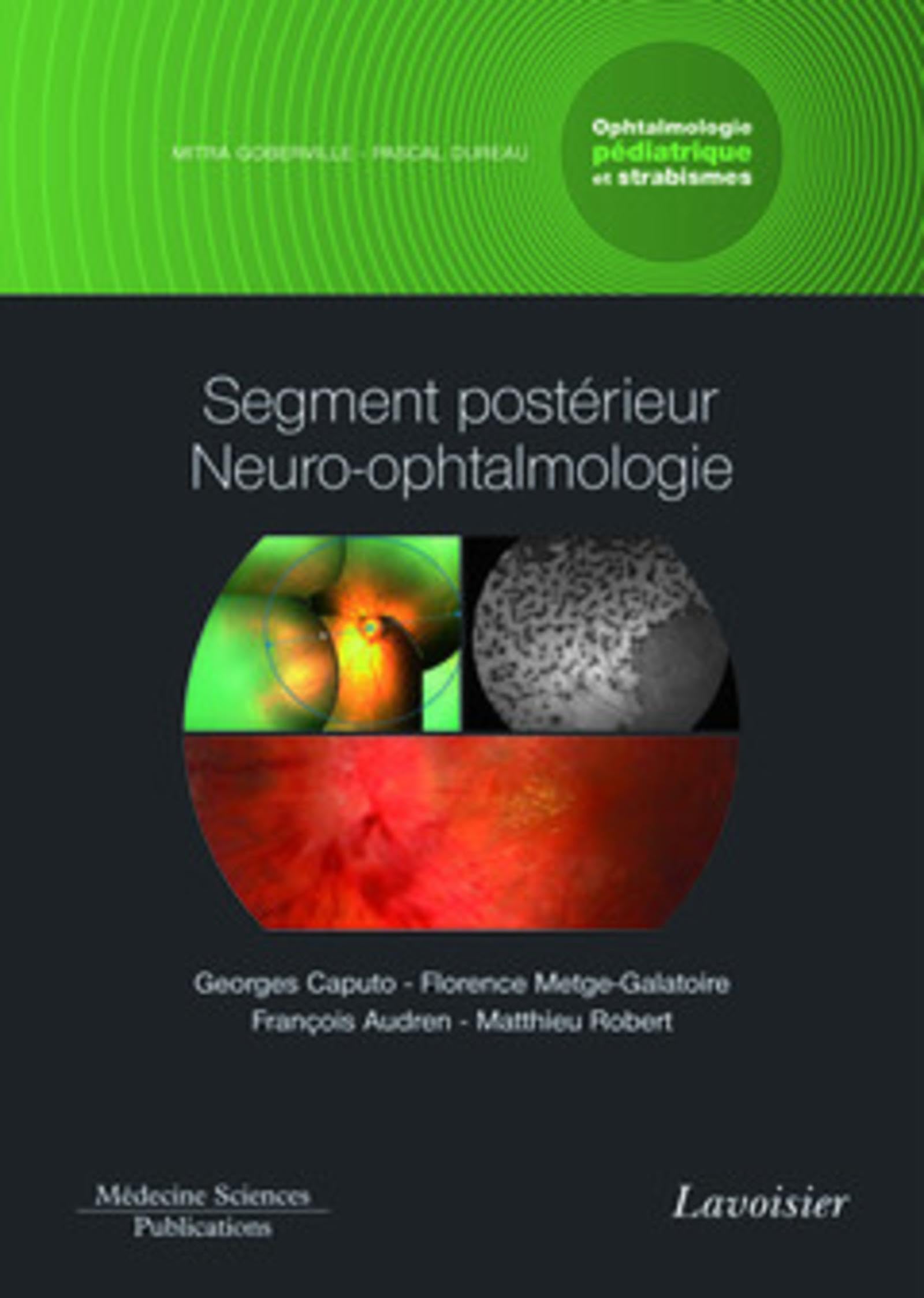 Segment postérieur neuro-ophtalmologie. Volume 3 - coffret Ophtalmologie pédiatrique et strabismes: Volume 3 - coffret Ophtalmologie pédiatrique et strabismes book