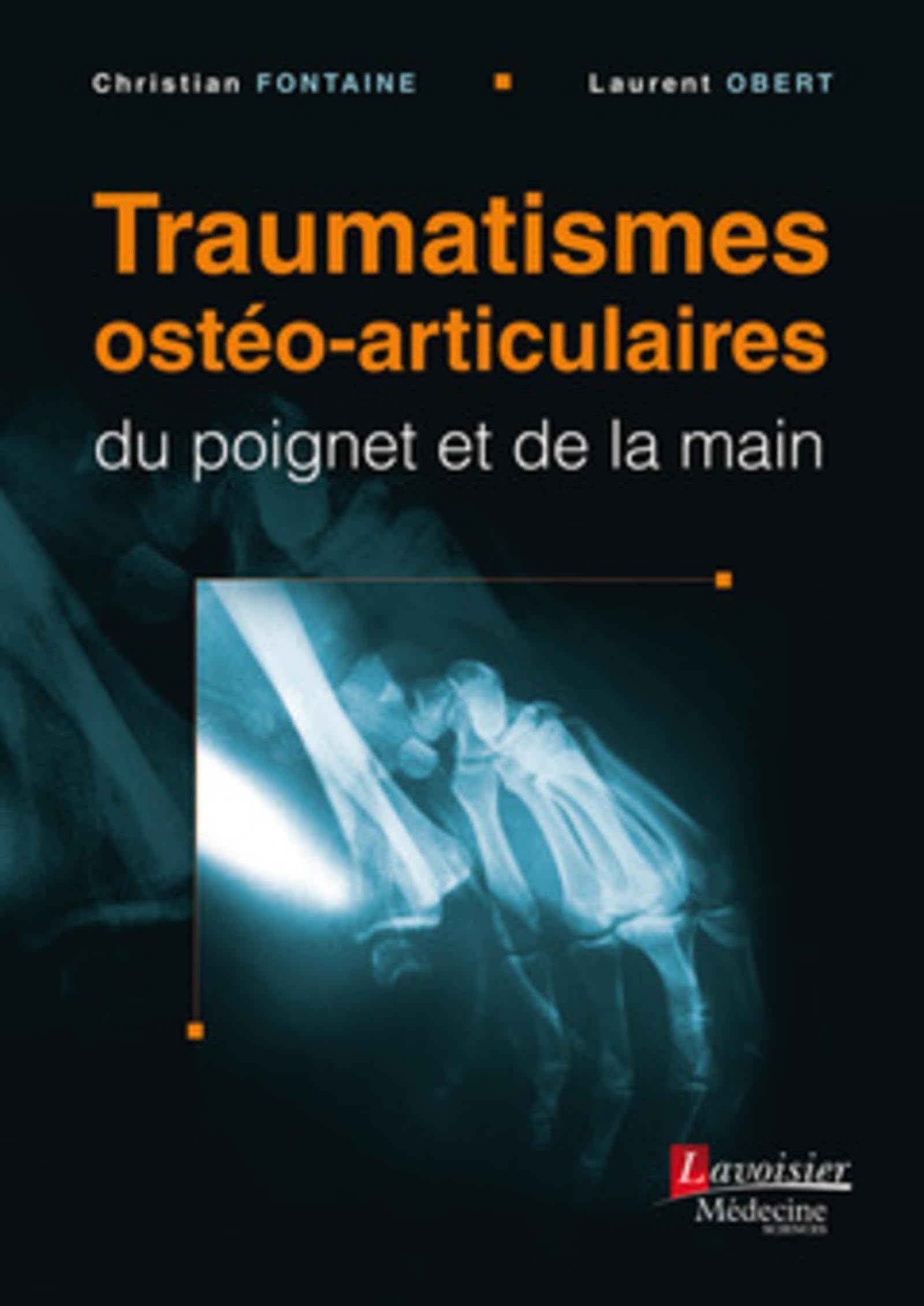 Traumatismes ostéo-articulaires du poignet et de la main book