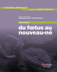 Imagerie du foetus au nouveau-né Medicine