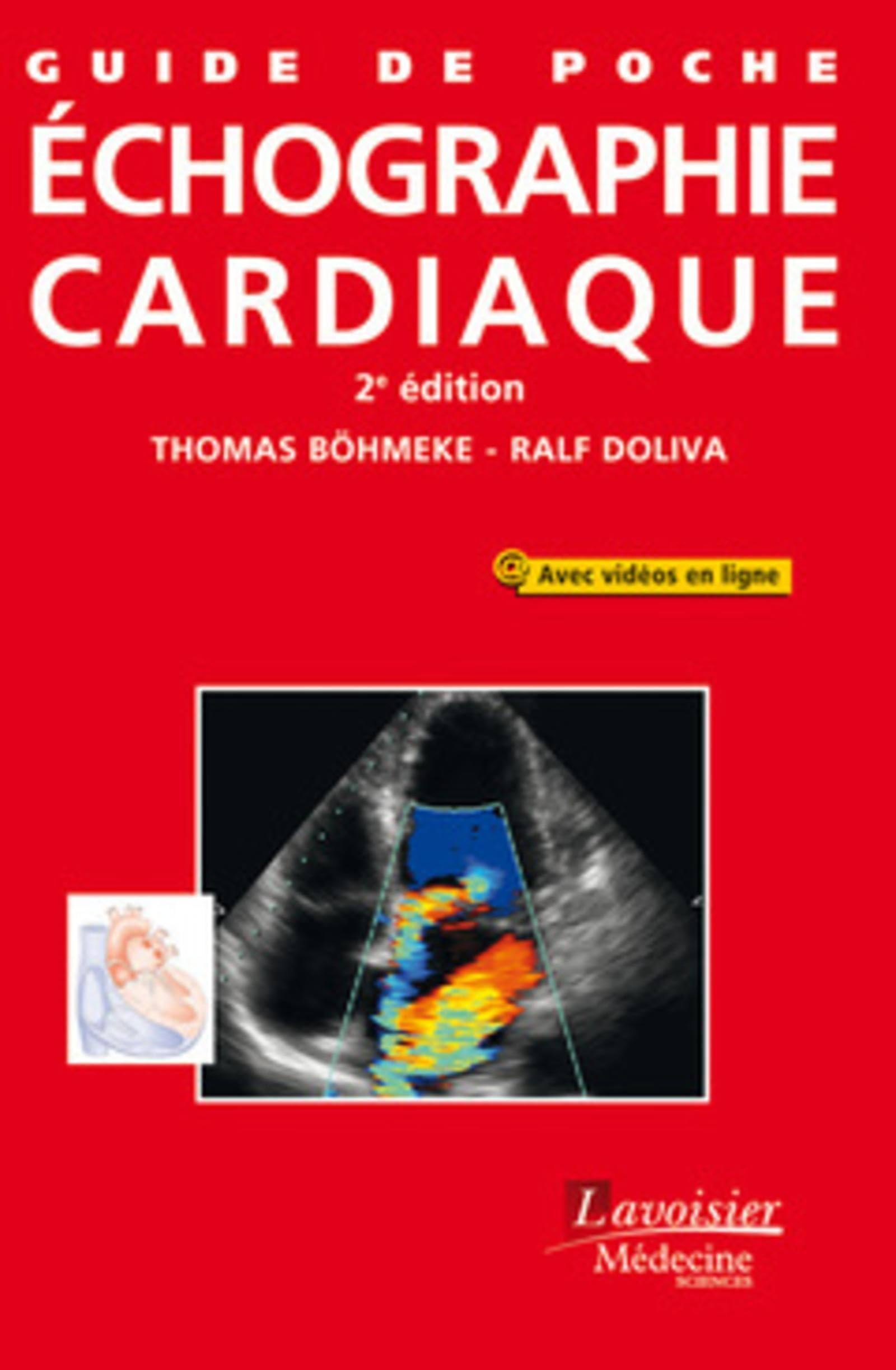 Guide de poche échographie cardiaque (2° Éd.) book