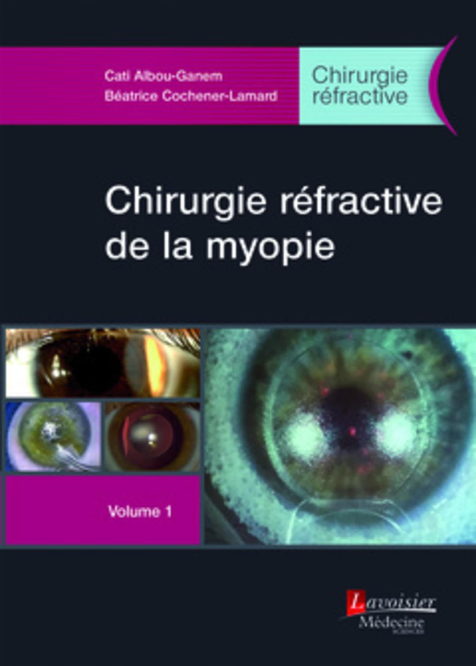 Chirurgie réfractive de la myopie - Volume 1 (Chirurgie réfractive) book