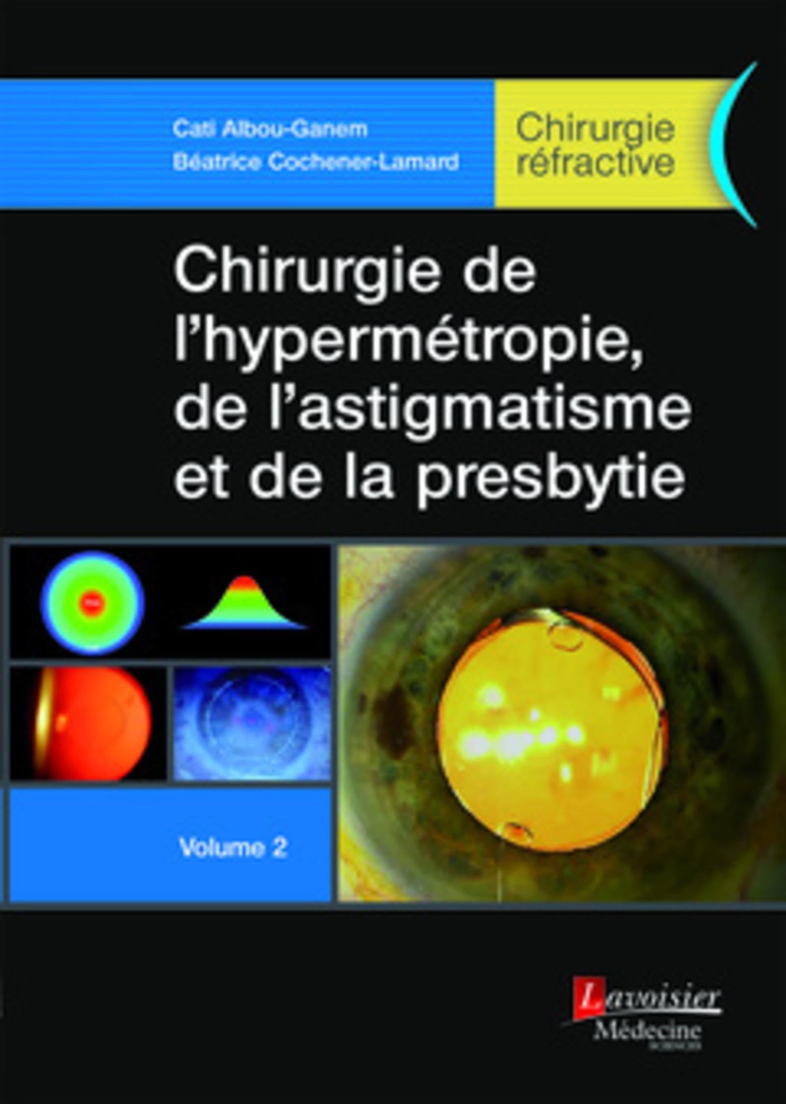 Chirurgie de l'hypermétropie, de l'astigmatisme et de la presbytie - Volume 2 (Chirurgie réfractive) book