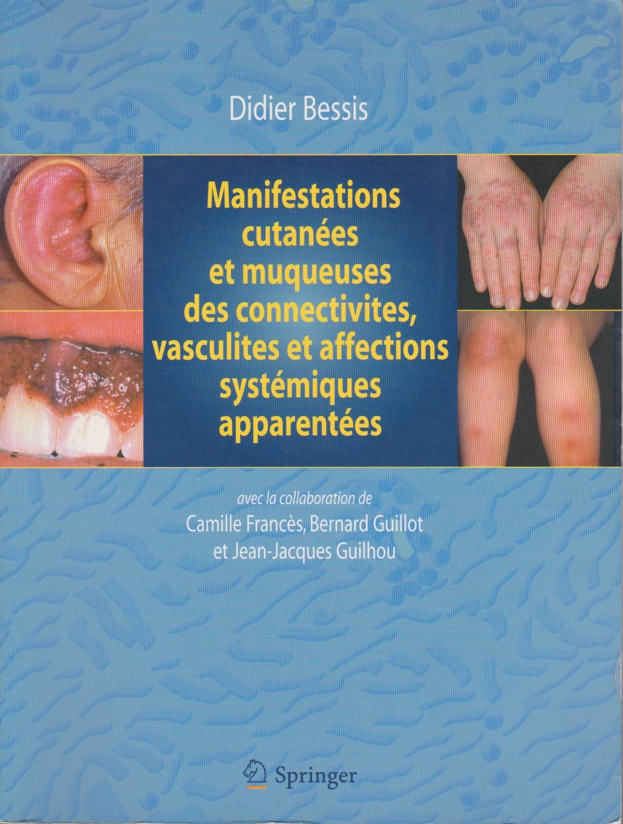 Manifestations cutanées et muqueuses des connectivites, vasculites et affections systémiques apparentées : Dermatologie et médecine, vol 1 book