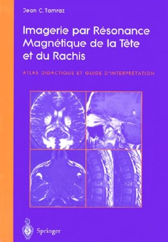 Imagerie par résonance magnétique de la tête et du rachis book