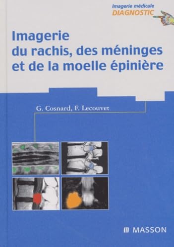 Imagerie du rachis, des méninges et de la moelle épinière book