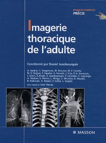 Imagerie thoracique de l'adulte Books