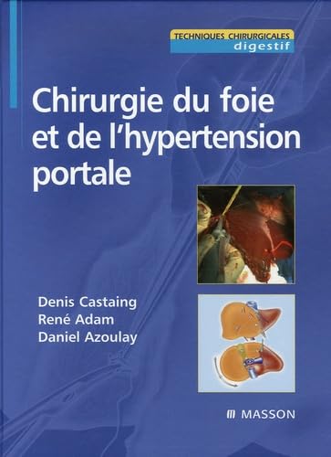 Chirurgie du foie et de l'hypertension portale book