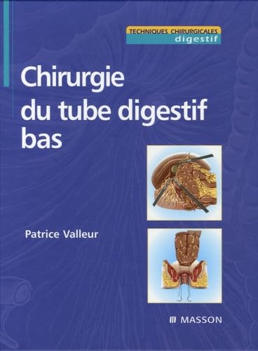 Chirurgie du tube digestif bas Medicine