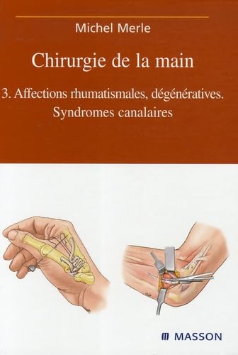 Chirurgie de la main : Tome 3, Affections rhumatismales, dégénératives - Syndromes canalaires (Ancien prix éditeur : 217 euros) book
