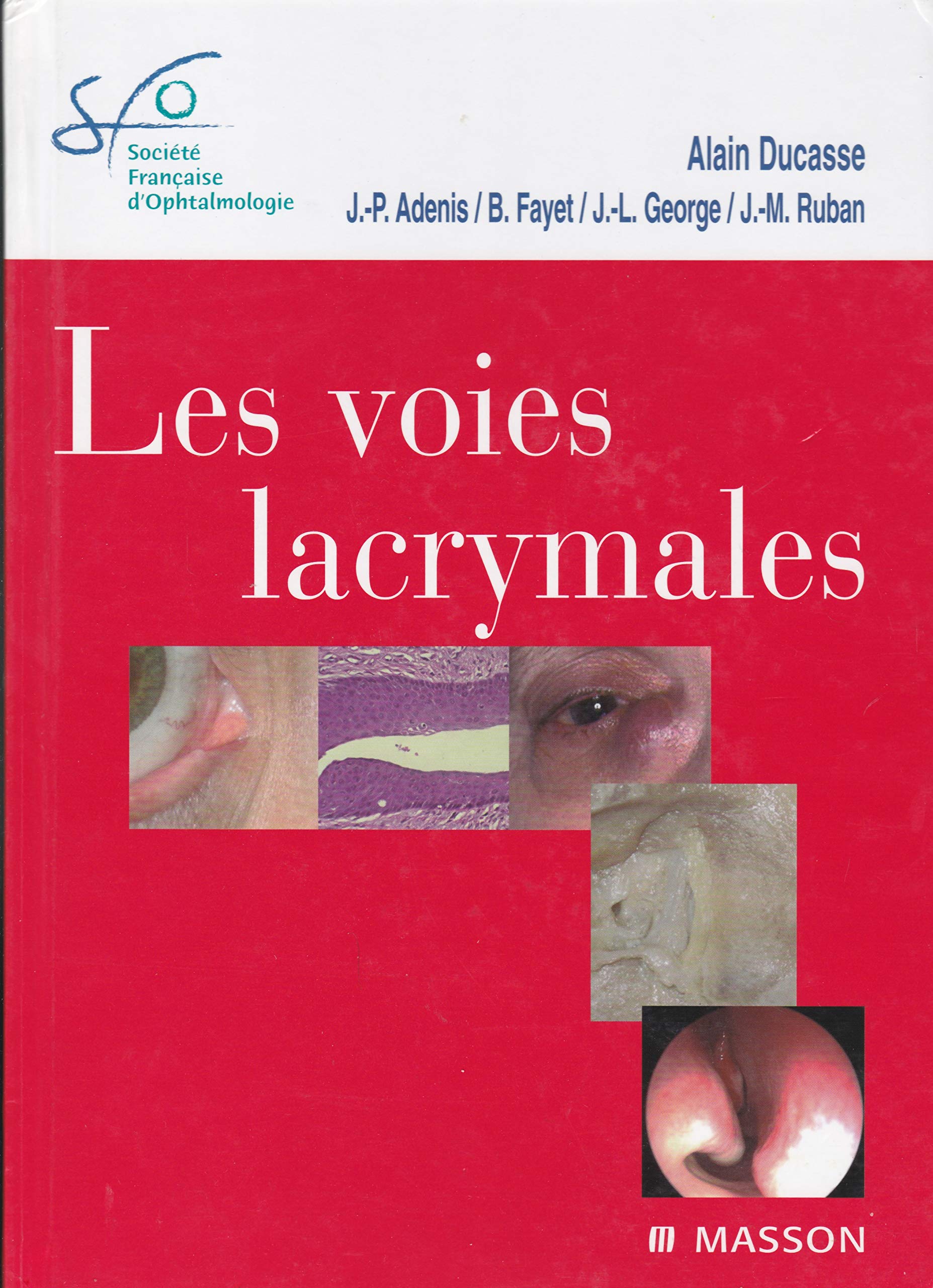 Les voies lacrymales book