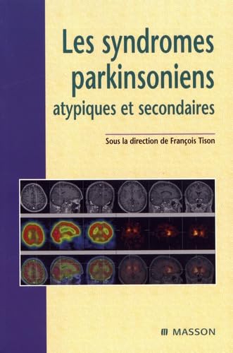 Les syndromes parkinsoniens atypiques et secondaires book