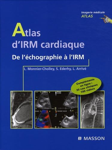 Atlas d'imagerie cardiaque : De l'échographie à l'IRM (Ancien Prix éditeur : 108 euros) book