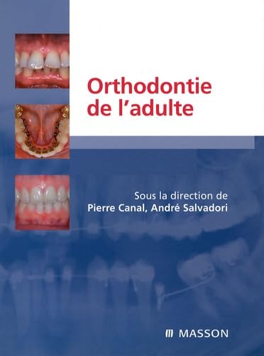 Orthodontie de l'adulte : Rôle de l'orthodontie dans la réhabilitation générale de l'adulte (Ancien Prix éditeur : 205 euros) book