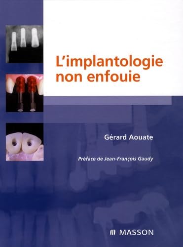 L'implantologie non enfouie book