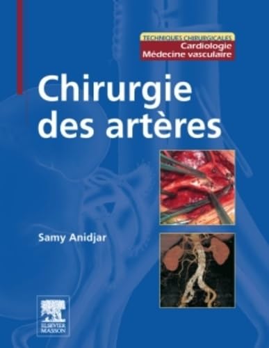 Chirurgie des artères: Pilon Partiel 15/2/16 book