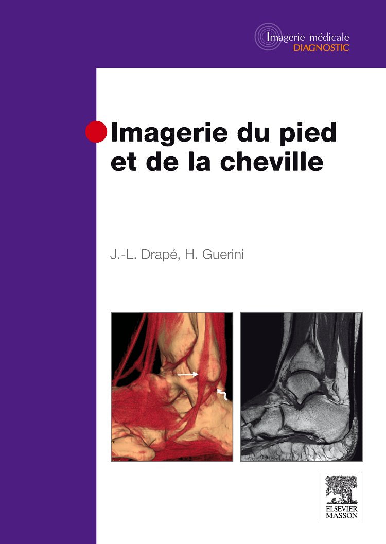 Imagerie du pied et de la cheville book
