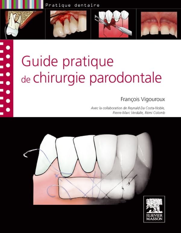 Guide pratique de chirurgie parodontale Medicine