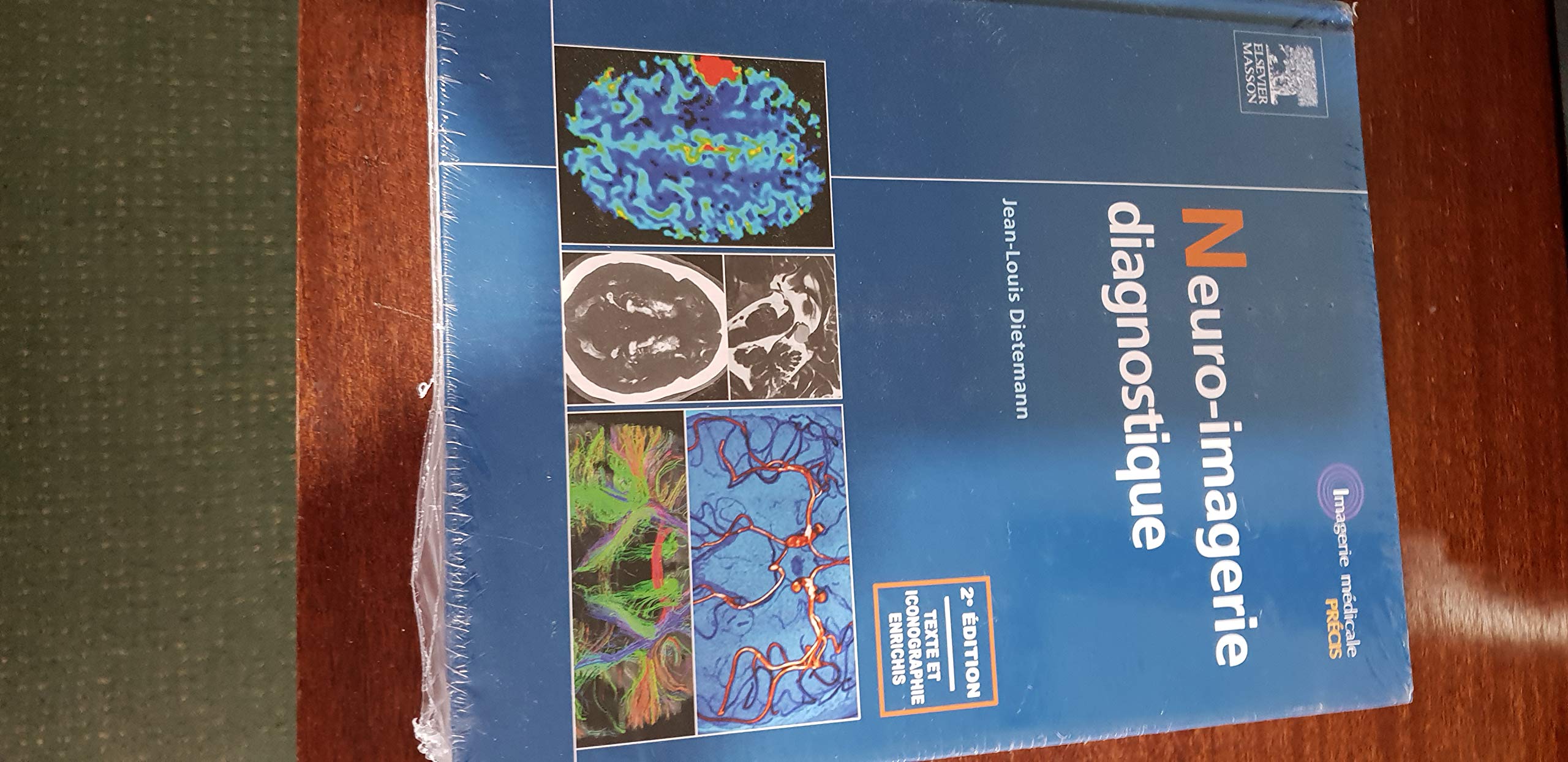 Neuro-imagerie Diagnostique Medicine