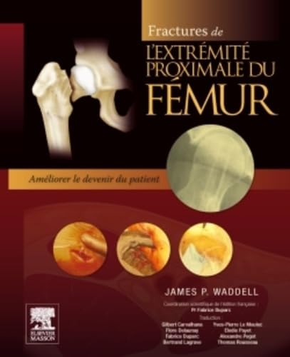 Fractures de l'extrémité proximale du fémur: Améliorer le devenir du patient book