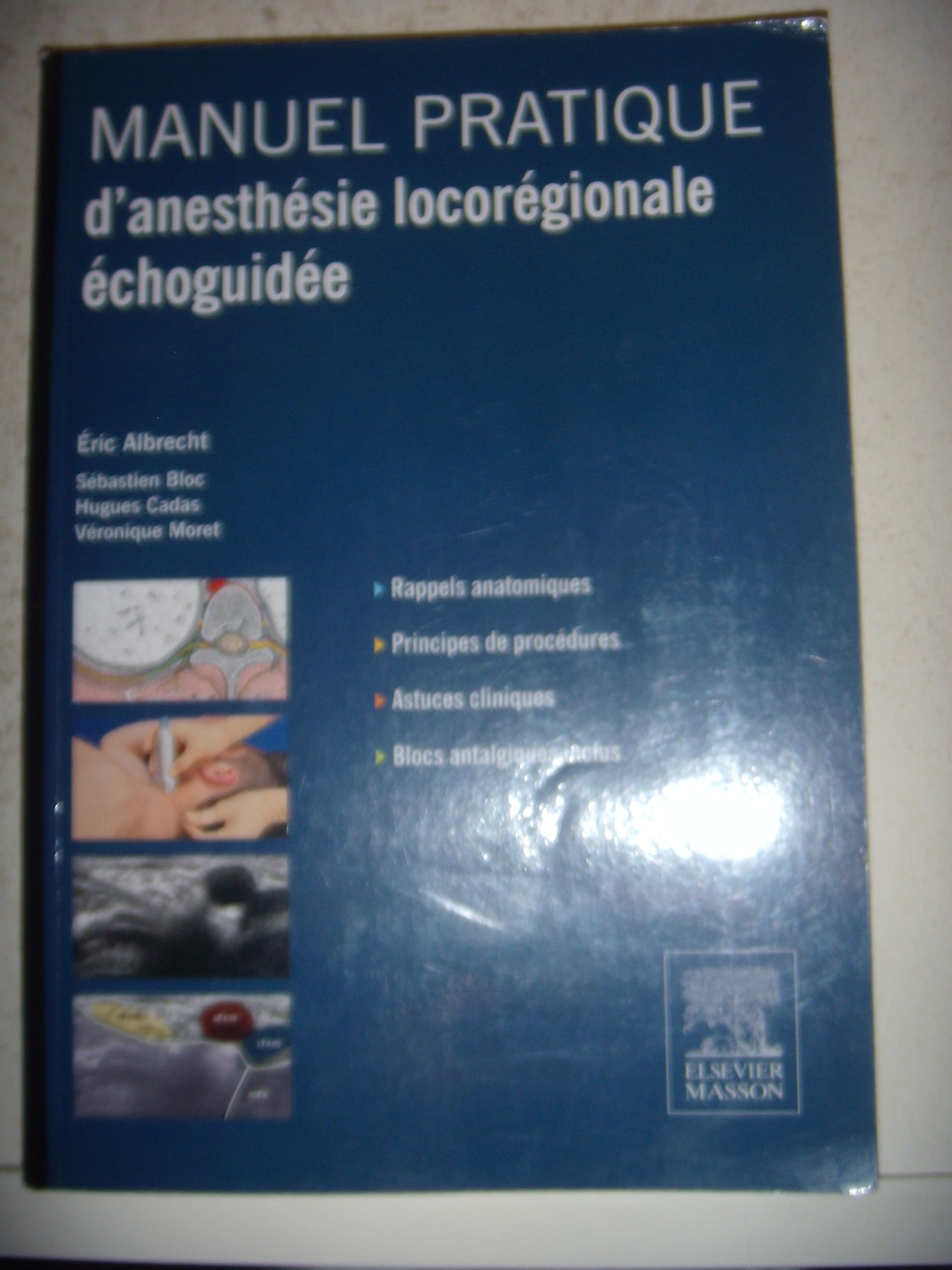 Manuel pratique d'anesthésie locorégionale échoguidée Medicine