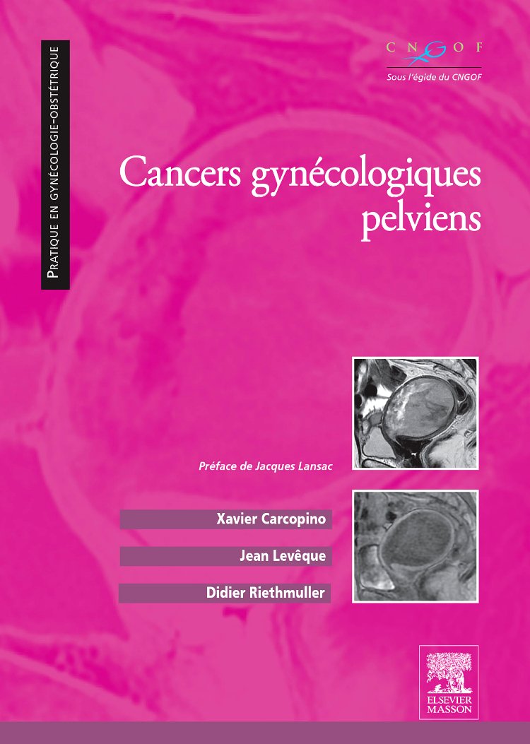 Cancers gynécologiques pelviens Medicine