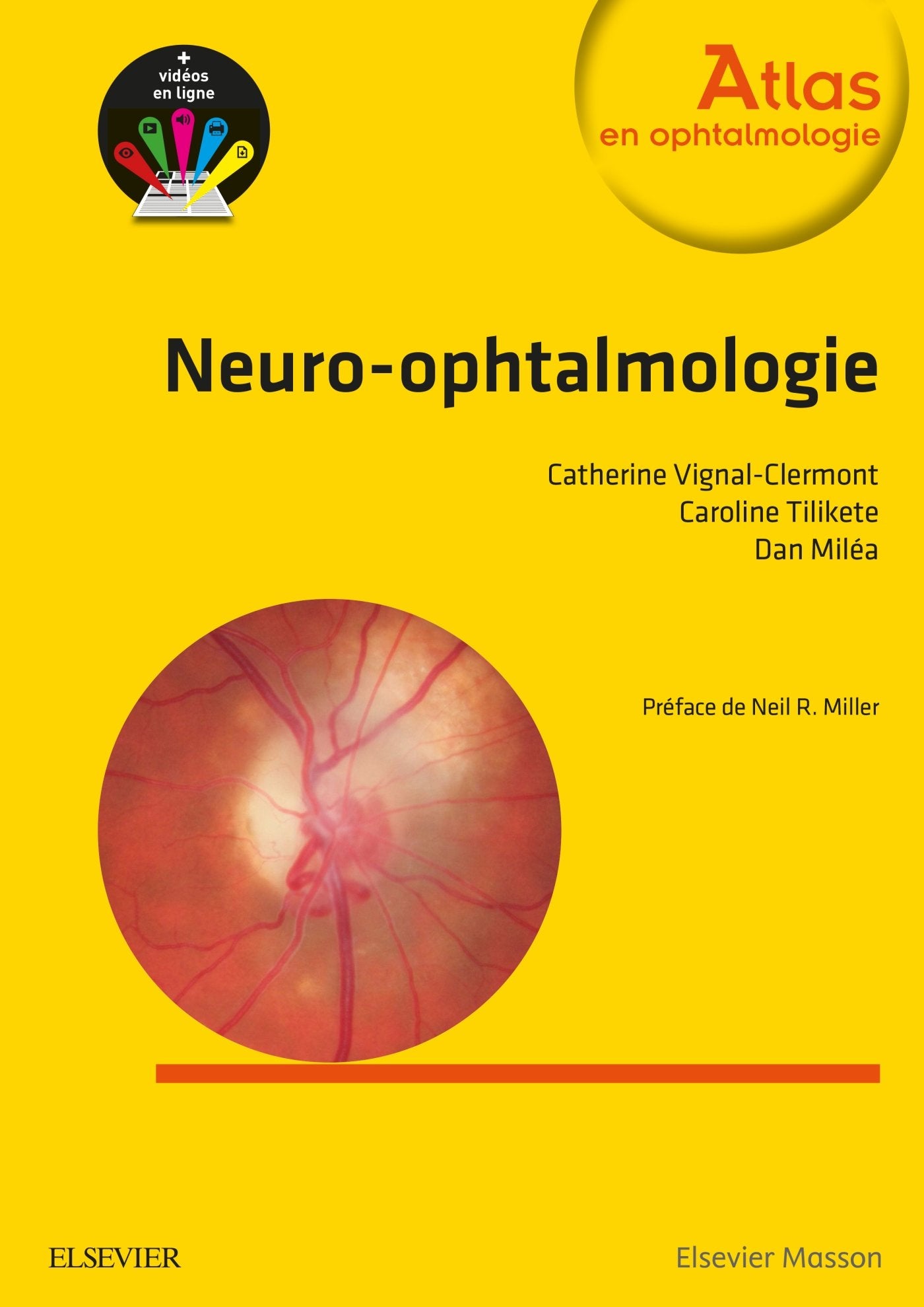 Neuro-ophtalmologie Medicine