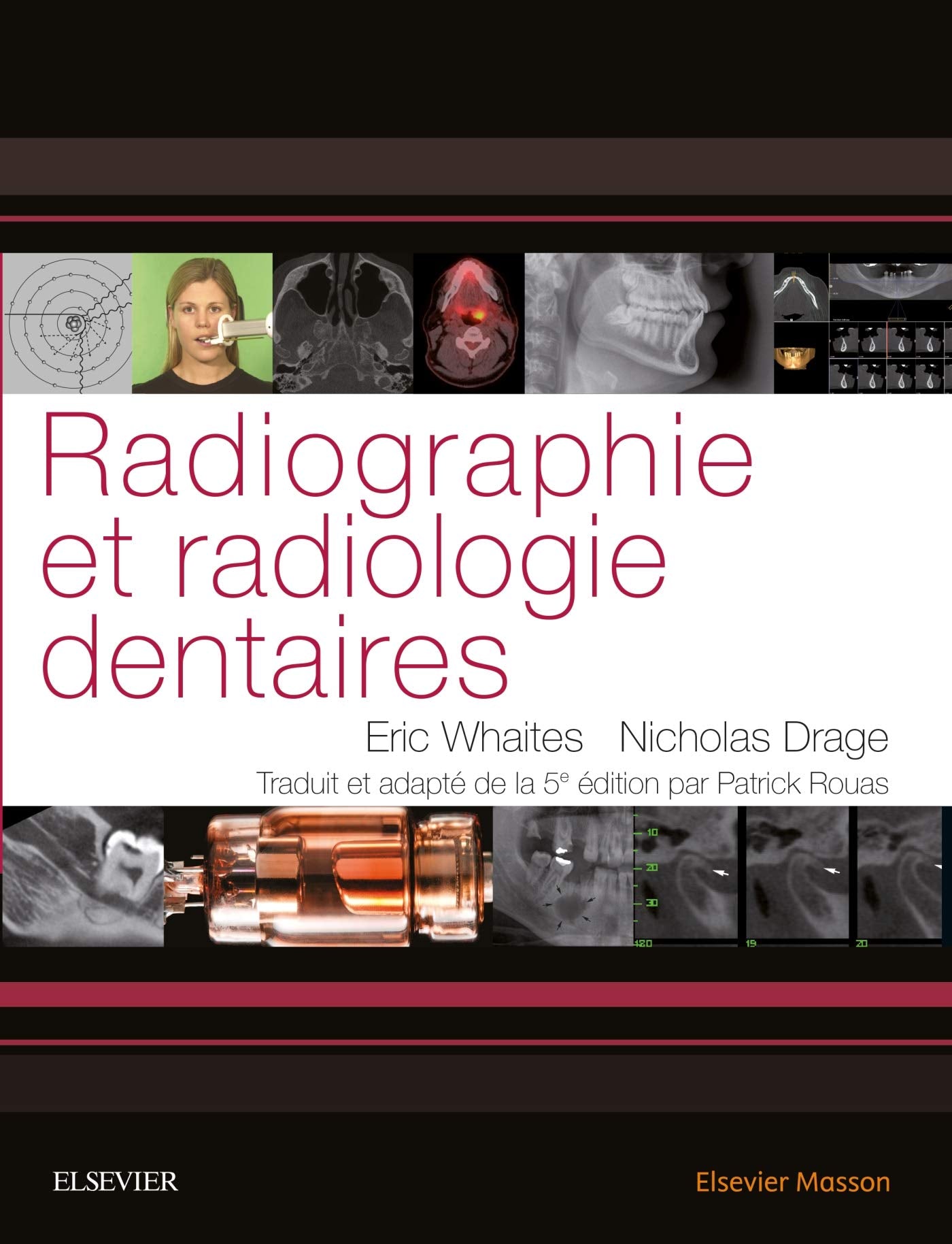 Radiographie et radiologie dentaires book
