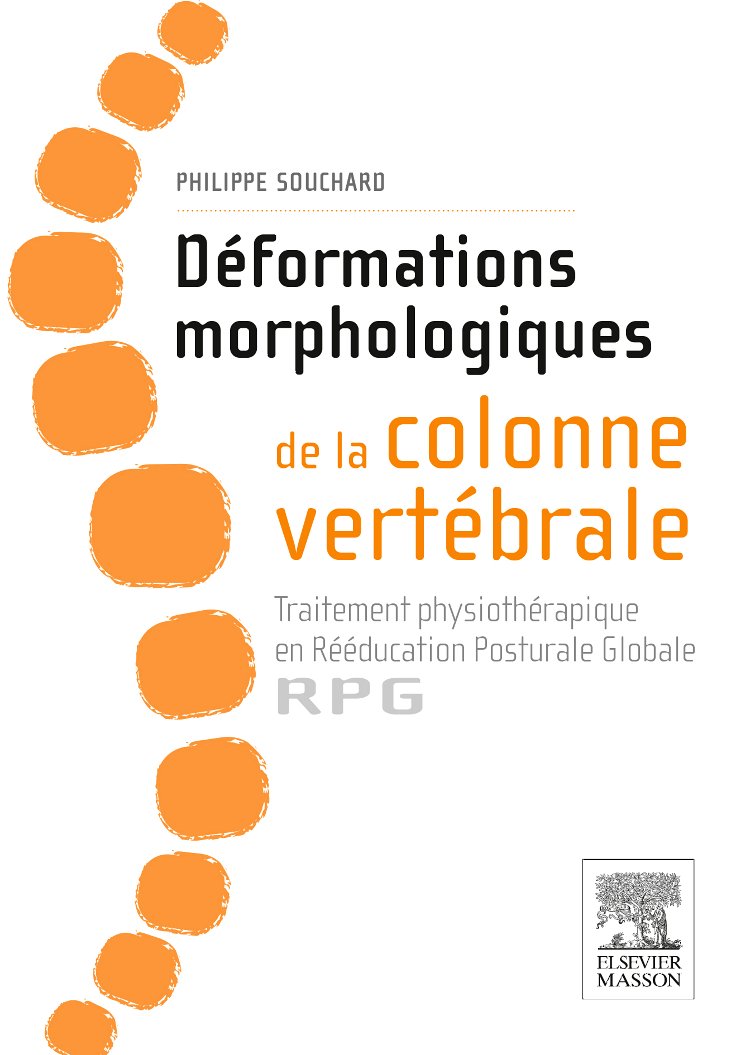 Déformations Morphologiques De La Colonne Vertébrale: Traitement Physiothérapique En Rééducation Posturale Globale-rpg Medicine