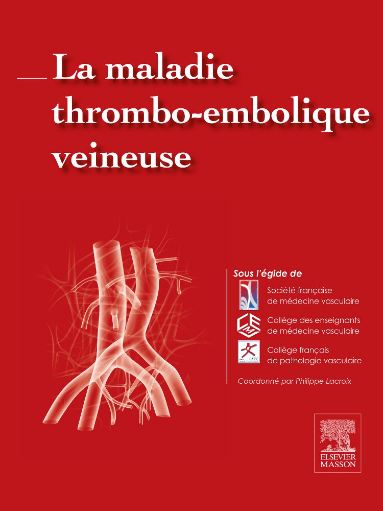 La maladie thrombo-embolique veineuse book